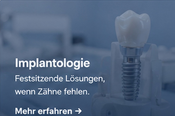 Dentalimplantat mit Zahnkrone – Implantologie
